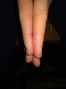 Vlad's hand